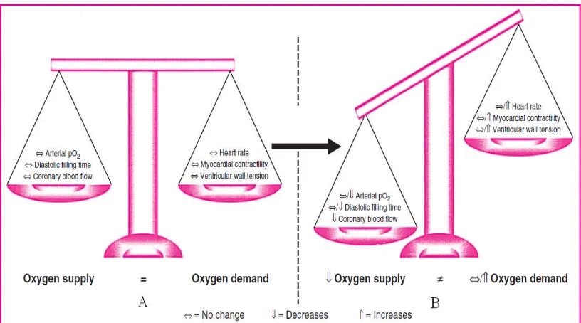 Gambar 2. Keseimbangan antara suplai dan kebutuhan oksigen (DiPiro, et al., 2008)