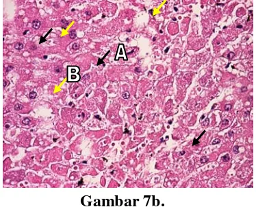 Gambar 7. Fotomikroskopi sel hati tikus jantan setelah praperlakuan jus buah pepaya dosis 10,65 g/kgBB terinduksi parasetamol dosis 0,9500 g/kgBB 