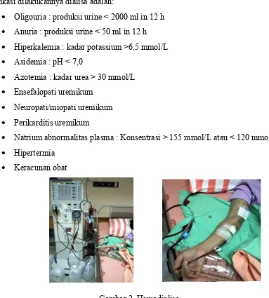 Gambar 2. Hemodialisa. 