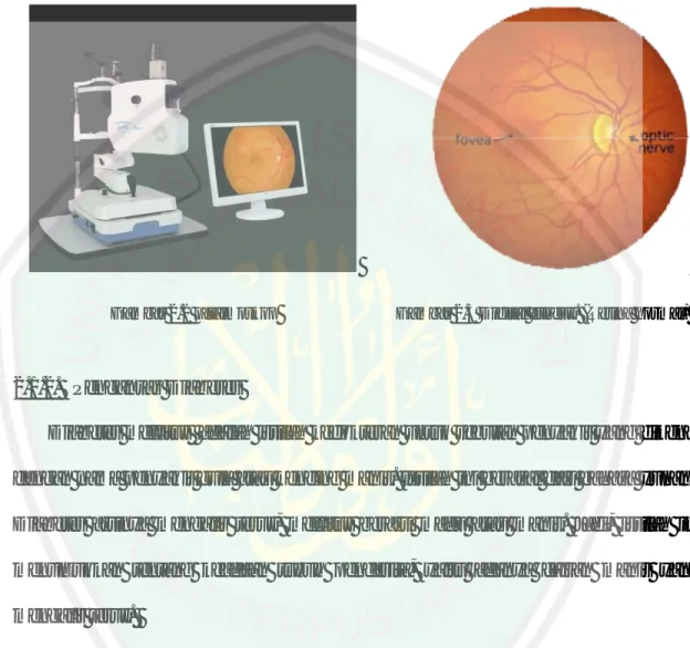 Gambar 2.2 oftalmoskop Gambar 2.3 Digital fundus. (Retina normal)