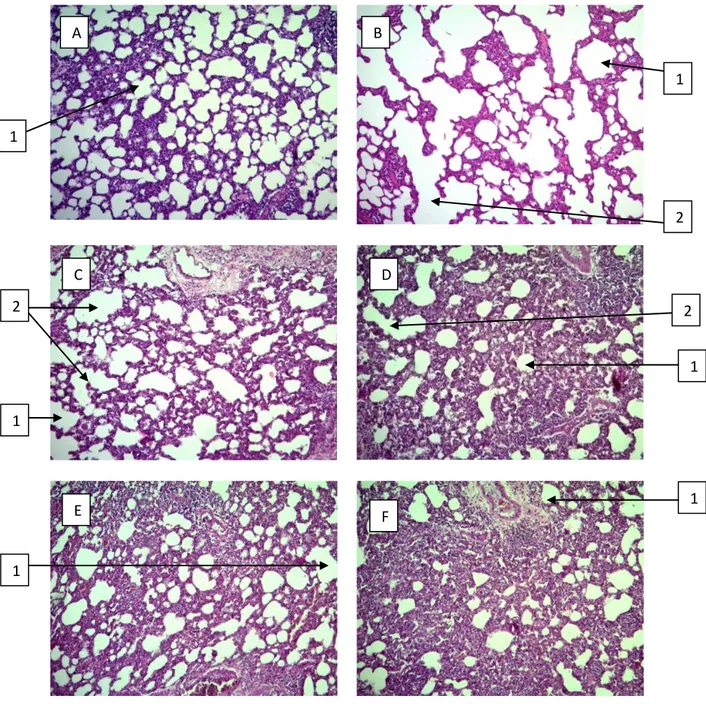 Gambar  2.  Gambaran  Parameter  Pelebaran  Lumen  Alveolus  :  a.  Kelompok  Normal;  b