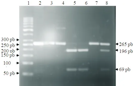 Gambar 1 Gambaran Elektroforesis Hasil PCR-RFLP Regio FokI