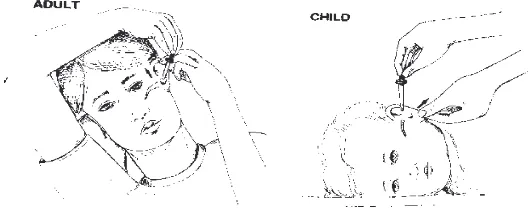 Gambar 2. Cara Penggunaan Tetes Telinga pada Dewasa dan Anak-Anak (Anonim, 2009). 