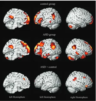 Figure 6.Brain activity during the self task (vs. high-level baseline) for ASD subjects and control subjects