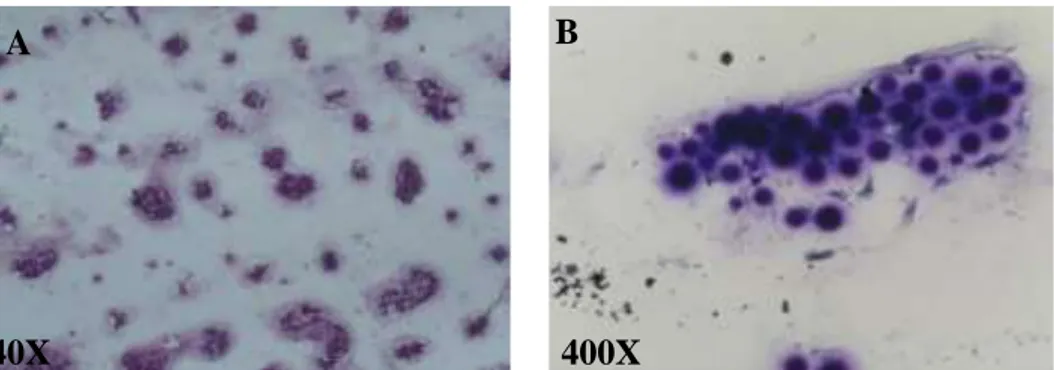 Gambar  1  Hasil  FNAB.  A&amp;B:  Tampak  kelompokan  sel  bentuk  bulat  (yeast)  dengan  berbagai  ukuran (Giemsa) 