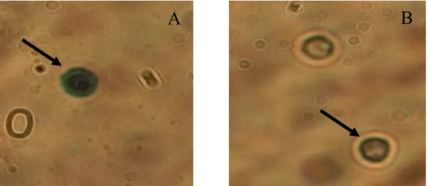 Gambar 4.  Sel  sperma  mati  udang  vaname  Litopenaeus  vannamei,  seluruh  permukaan  sel  berwarna  biru  hitaman  (A)  dan  lapisan  luar  sel  berwarna  biru   kehitam-hitaman (B)
