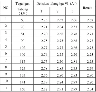 Tabel  4.2  Hasil pengukuran Densitas Rongga Thorax 