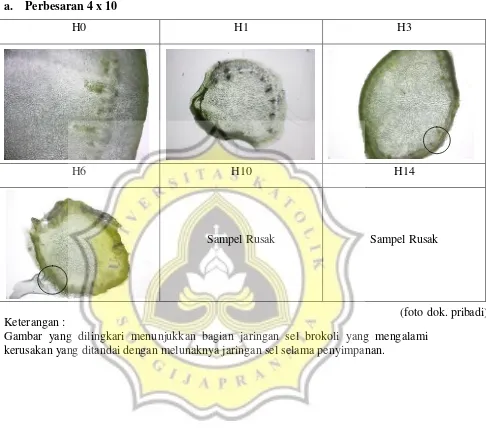 Gambar yang dilingkari menunjukkan bagian jaringan sel brokoli yang mengalami 