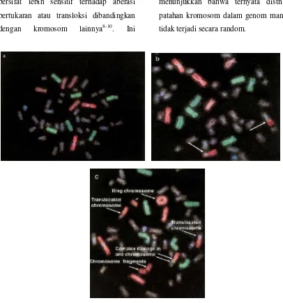 Gambar 2. (a) Sel dengan kromosom  normal; (b). Sel dengan kromosom translokasi resiprokal; dan (c) sel dengan berbagai jenis aberasi kompleks.Kromosom pada sel darah limfosit manusia yang dicat dengan warna merah (22,07% dari genom) pada kromosom no
