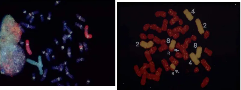 Gambar 3. Deteksi translokasi dan insersi dengan kromosom (chromosomessingle and multi-coloured FISH of whole   (A) triple coloured FISH pada kromosom no.1 (hijau), no.4 (merah), dan  semua pancentromeric probe)