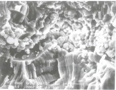 Figure 16: Interface of alumina beads with small spherical particles trapped between  columnar grains