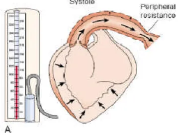 Gambar 1. Diagram sisi kanan dari jantung dan aorta. (A) tekanan darahsistolik digambarkan dengan aliran darah menuju aorta selama kontraksiventrikular