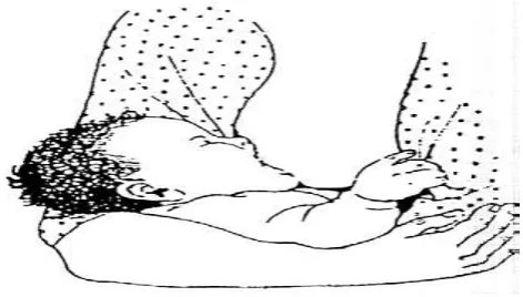 Gambar 3: Tekhnik menyusui yang benar 