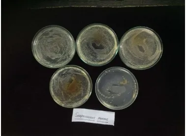 Gambar 4.8 Penghambatan pertumbuhan bakteri Streptococcus mutans oleh ekstrak 