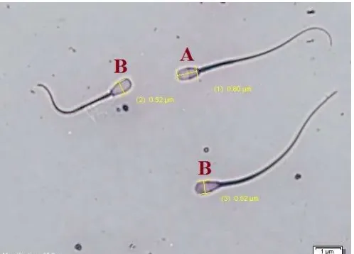 Gambar pengukuran panjang dan lebar kepala spermatozoa hasil pewarnaan 