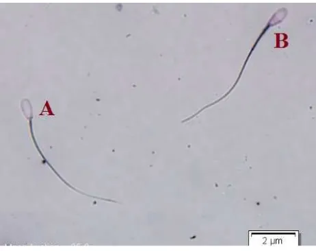 Gambar 1. Hasil Pengamatan Viabilitas Spermatozoa Setelah Proses Sexing Keterangan: A: Spermatozoa hidup; B: Spermatozoa mati 