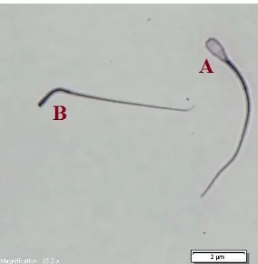 Gambar 2. Hasil Pengamatan Abnormalitas Spermatozoa Setelah Proses Sexing  Keterangan: A: Spermatozoa normal; B: Spermatozoa abnormal 
