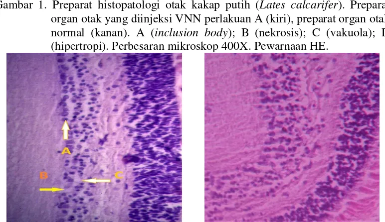Gambar 1. Preparat histopatologi otak kakap putih (Lates calcarifer). Preparat 