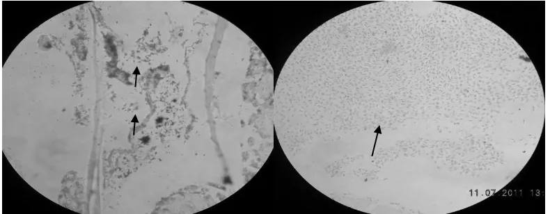 Gambar 4.Sel kromatofor pada awal (kiri) dan pada akhir (kanan) penelitian 