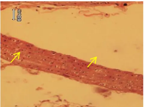 Gambar  3. Gambaran mikroskopik aorta tikus  wistar kelompok B potongan  melintang dengan perbesaran 40x10
