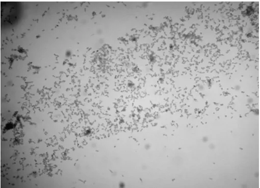 Gambar 1. Bentuk difteroid morfologi bakteri  Corynebacterium ulcerans dengan pewarnaan Albert 