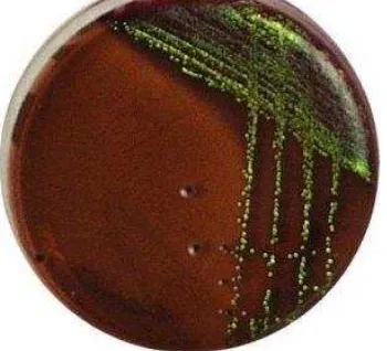 Gambar 2.4. Escherichia coli pada agar Mac Conkey (Brooks et al, 2007) 