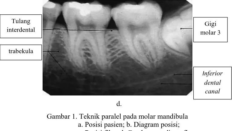 Gambar 1. Teknik paralel pada molar mandibula a. Posisi pasien; b. Diagram posisi;  