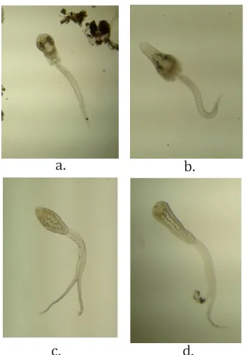 Gambar 2. Jenis serkaria yang ditemukan pada                       (c,d)                       keong: (a,b) Gymnocephalus cercariae, Ocelifera cercariae
