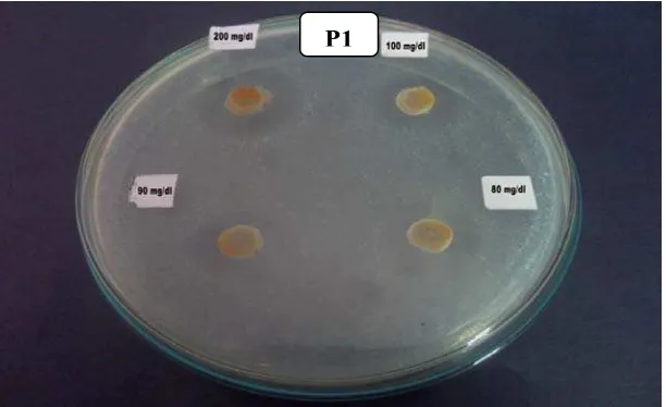 Gambar hasil pengujian aktivitas anti jamur ekstrak rimpang      lengkuas merah terhadap jamur Pityrosporum ovale 