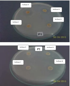 Gambar hasil pengujian aktivitas anti jamur sampo ekstrak rimpang lengkuas merah terhadap jamur Pityrosporum ovale 