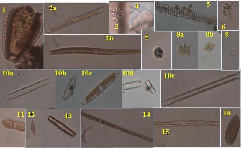 Gambar 2. Biota Mikro yang Ditemukan di Tempat Perkembangbiakan Anopheles spp. 