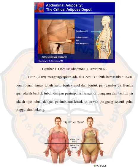 Gambar 1. Obesitas abdominal (Lazar, 2007) 