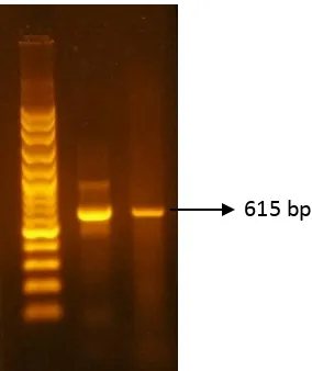 Gambar 1.                    Patogen pada Sampel Urin ( Hasil Elektroforesis Produk PCR yang Positif Mengandung Bakteri Leptospira  lane 1) dan Sampel Darah (lane 2) 