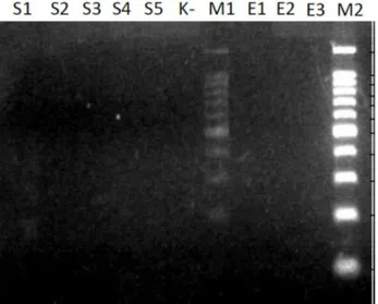 Gambar 1. Elektroforegram PCR tahap pertama dari Salmonella thypi. Dimana S. typhi sebagai  kontrol  positif  (S1,  S2,  S3,  S4,  S5);  E
