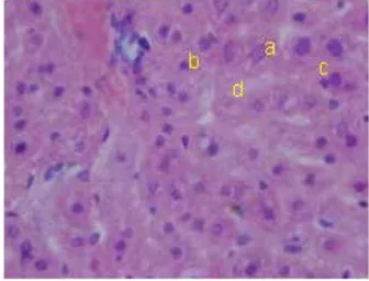 Gambar 2. Foto zona 1 lobulus hepar mencit kelom-pok perlakuan I (Perbesaran 400x).