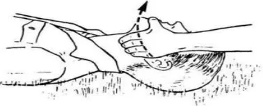 Gambar 2.3. Posisi badan serta tangan penolong pada dada korban 