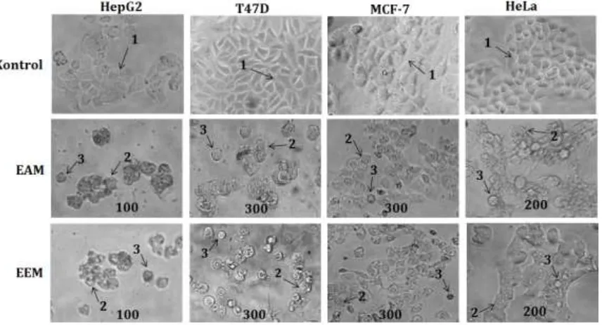 Gambar 1. Perubahan morfologi sel karena perlakuan EAM dan EEM. Sel dikultur dalam 96 well plate,  morfologi sel diamati di bawah mikroskop inverted perbesaran 200x