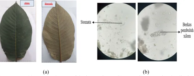 Gambar 1.  (a) penampakan morfologi S. vulcani, (b) pemeriksaan makroskopik dan  pemeriksaan mikroskopik daun S