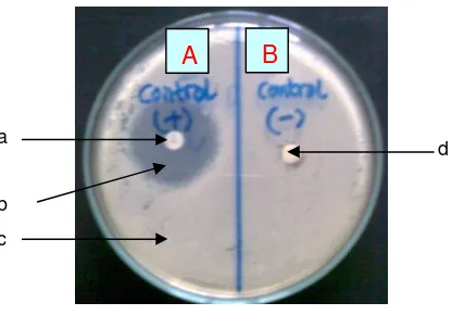 Gambar 2. Zona hambat: A. Eritromisin pada konsentrasi 15 µg; dan B. Aquades 