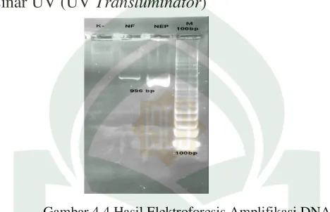 Gambar 4.4 Hasil Elektroforesis Amplifikasi DNA 