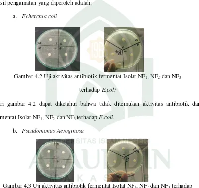 Gambar 4.3 Uji aktivitas antibiotik fermentat Isolat NF1, NF2 dan NF3 terhadap 