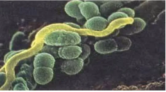 Gambar 2.2 Bakteri Streptocoocus mutans 