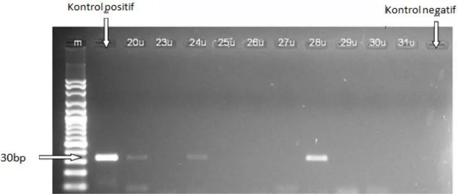 Gambar 1. Hasil produk PCR DNA dari urine anjing menggunakan primer Lepat 1 dan Lepat 2.m: marker 100 bp