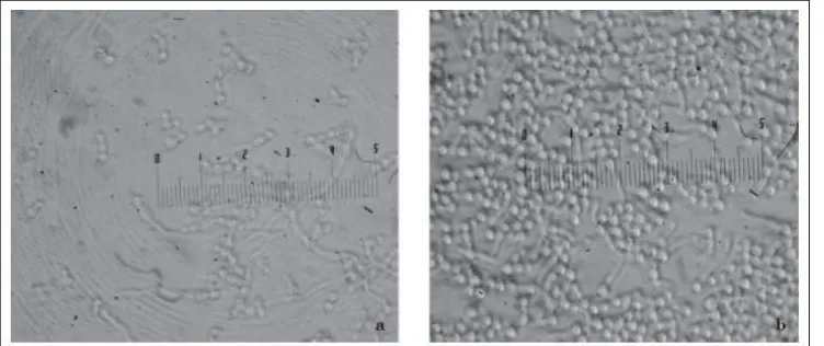 Gambar 1. Kenampakan biofilm C. albicans(a) filtrat kultur  selama 48 jam terhadap paparan Pseudozyma spp