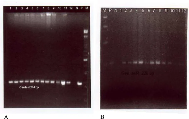 Gambar 1. Hasil Pemeriksaan RT-PCR terhadap gen biofilm, (A) gen 1asL, (B) gen 1asR dari 12 isolat Pseudomonas aeruginosa penderita otitis media supuratif kronis  