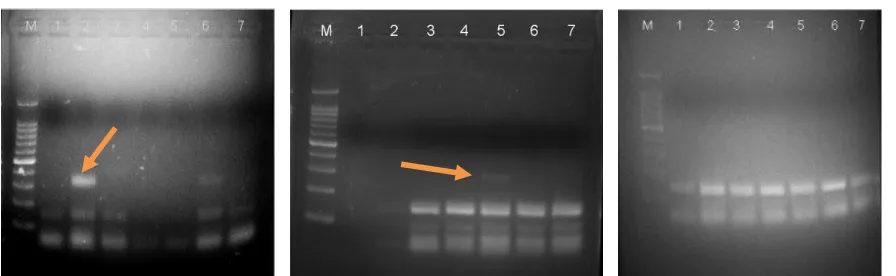 Gambar 1. Hasil amplifikasi PCR (positif) sampel 5 ekor nyamuk/pool Batumarta X Kabupaten Ogan Komering Ulu Timur (berasal dari Desa Serasah Kec