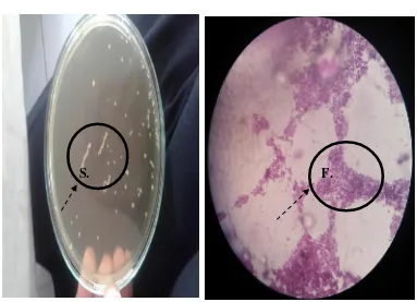 Gambar 1.1 huruf (S) hasil dari pemurnian Pediococcus Pediococcus setelah dilakukan pewarnaan dengan perbesaran lensa 1000x