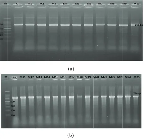 Figure 3. Agarose gel electrophoresis of PCR-amplified coa mgenes from of S. aureus. stSRmM=Marker (DNA Ladder m100 bp), KP= Positive Control (756 bp)