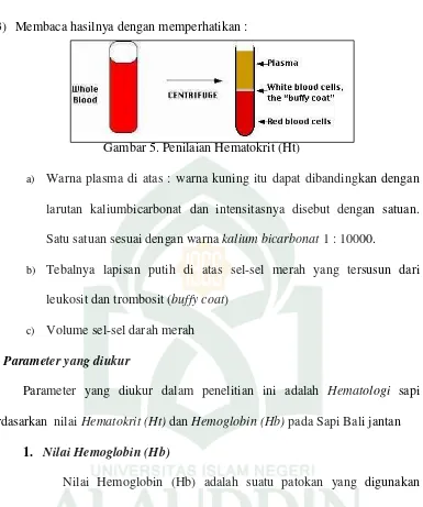 Gambar 5. Penilaian Hematokrit (Ht) 