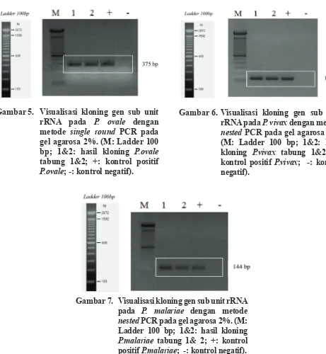 Gambar 6.  Visualisasi kloning gen sub unit rRNA pada P. vivax dengan metode nested PCR pada gel agarosa 2%